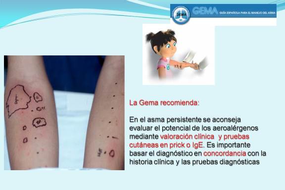 PRUEBAS CUTÁNEAS EN EL DIAGNOSTICO DE LA ALERGIA